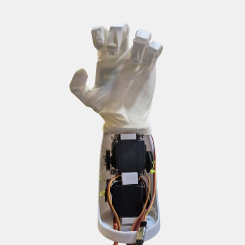 AI Prosthetic Hand